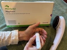 A scar management device used for the treatment of multiple hand wounds.